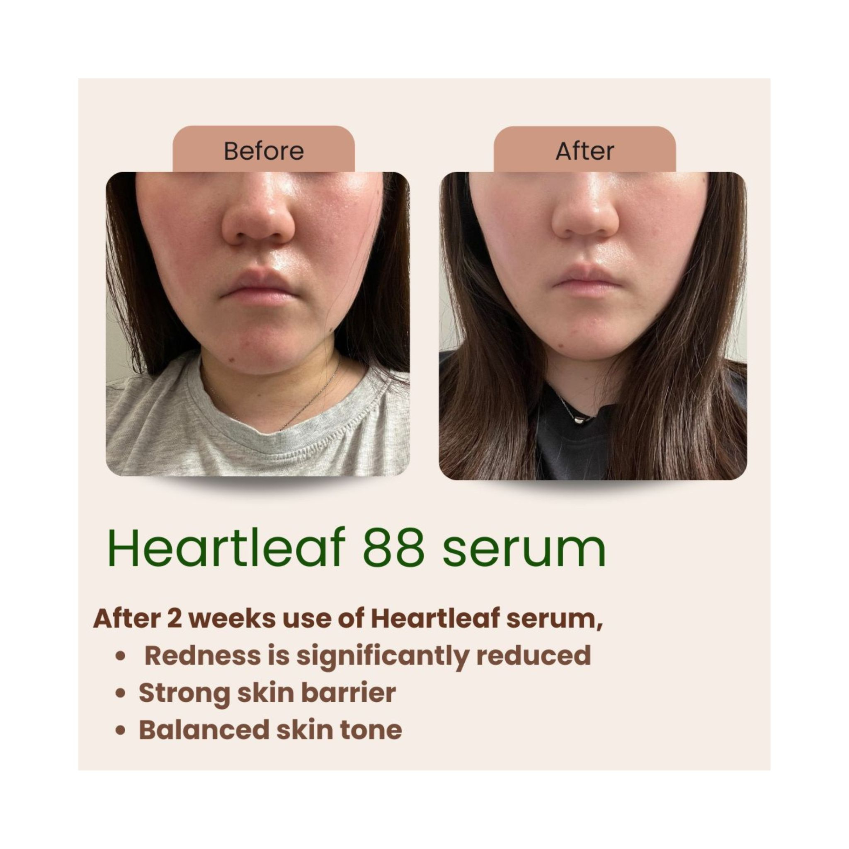 Rêveskin Heartleaf 88 Glow Serum