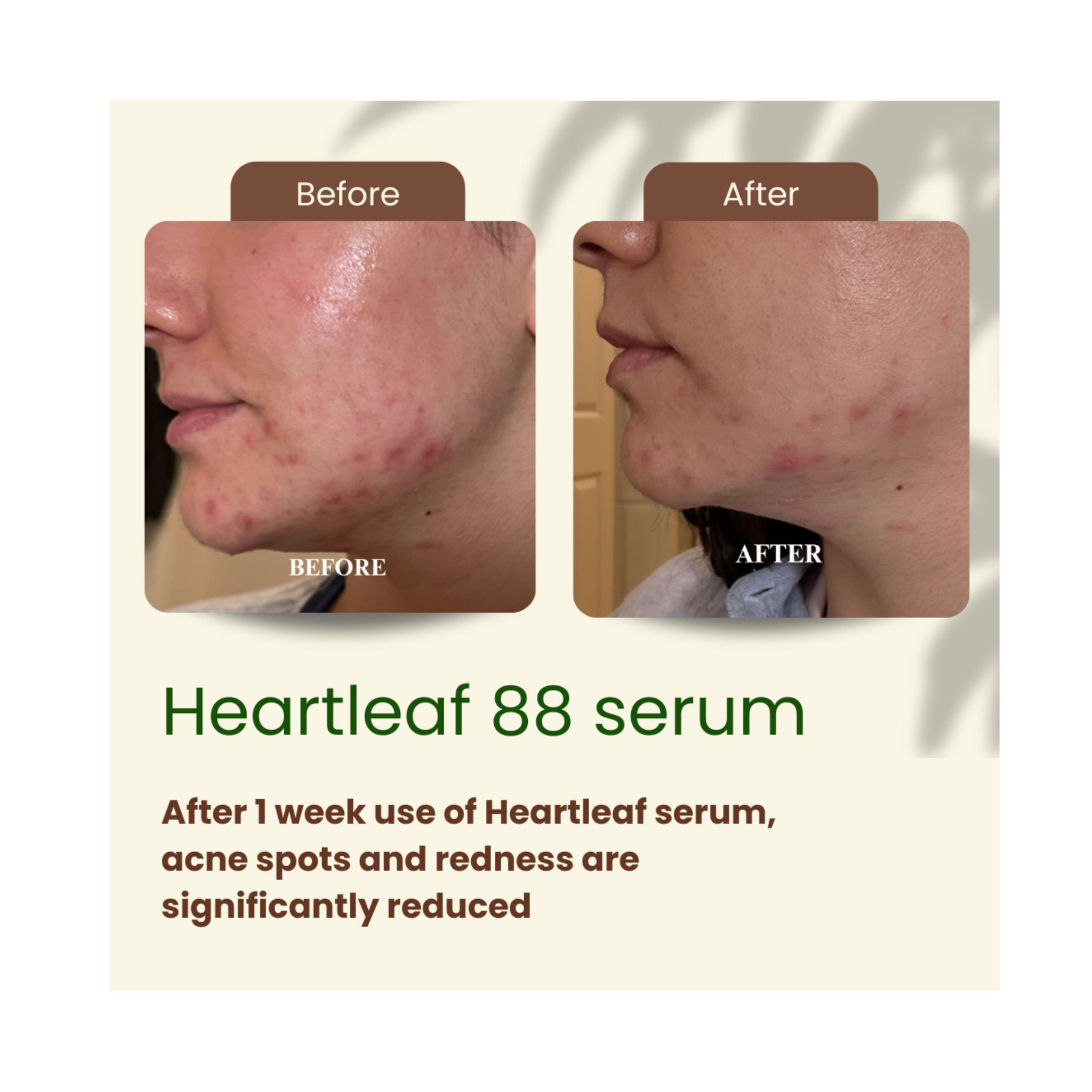 Rêveskin Heartleaf 88 Glow Serum