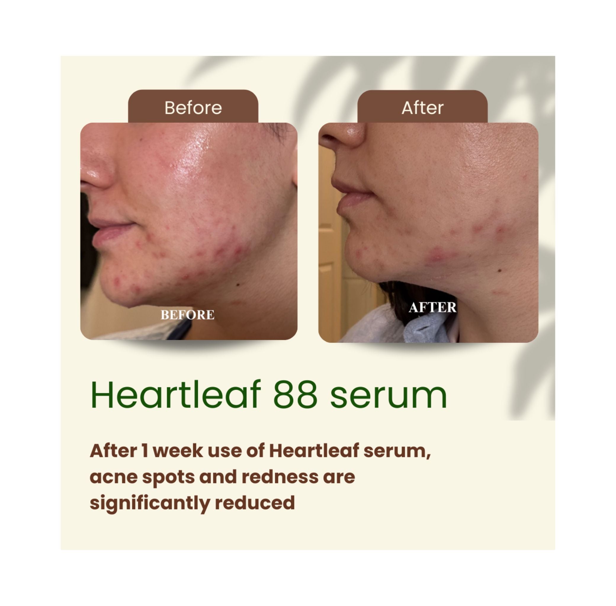 Rêveskin Heartleaf 88 Serum